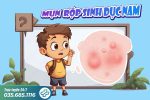 Mụn rộp sinh dục nam: Nguyên nhân và phương pháp điều trị