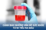 Phòng khám đa khoa Quận 1 HCM – Điều trị khỏi bệnh tiểu ra máu bằng hệ thống CRS