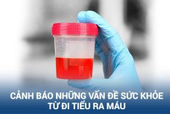 Phòng khám đa khoa Quận 1 HCM – Điều trị khỏi bệnh tiểu ra máu bằng hệ thống CRS