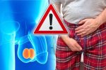 [CẢNH BÁO] Các bệnh lý tinh hoàn thường gặp và cách điều trị an toàn, hiệu quả
