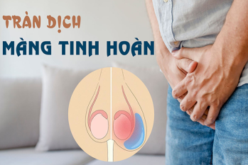 Tràn Dịch Màng Tinh Hoàn – Nguyên Nhân, Triệu chứng và Cách Điều Trị