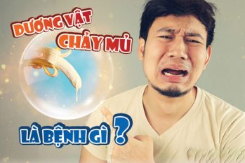 Cảnh báo dương vật chảy mủ: Dấu hiệu bất thường nam giới cần chú ý