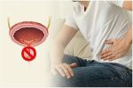 Bí tiểu ở nam giới: Nguyên nhân, Biểu hiện và Cách khắc phục hiệu quả