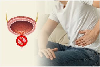 Bí tiểu ở nam giới: Nguyên nhân, Biểu hiện và Cách khắc phục hiệu quả