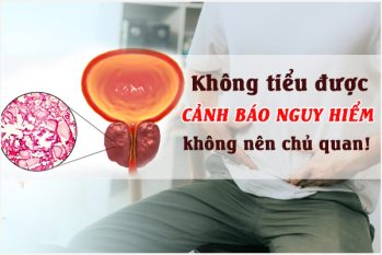 Mắc tiểu nhưng không tiểu được phải làm sao? Cách khắc phục nhanh và hiệu quả