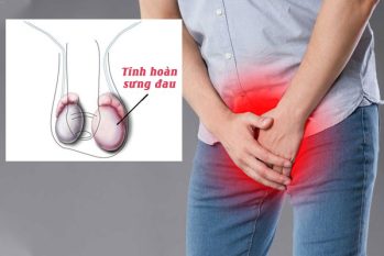 Sưng tinh hoàn – Dấu hiệu cảnh báo bệnh nam khoa nguy hiểm